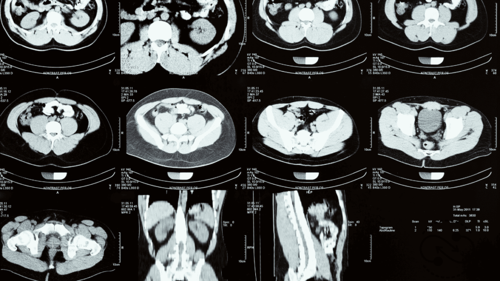  Benefits of Optical Coherence Tomography